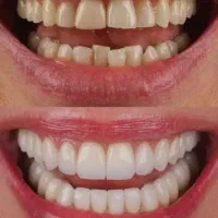 اموزش لابراتوار به صورت حرفه ای|خدمات آموزشی|تبریز, |دیوار