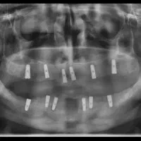 خدمات دندان پزشکی با متناسب شرایط و بودجه شما|خدمات آرایشگری و زیبایی|رودبار, |دیوار
