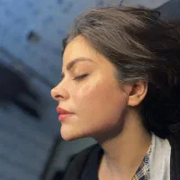 تزریق ژل و بوتاکس|آرایشگاه و سالن‌های زیبایی|ری, دولت‌آباد|دیوار