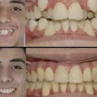 جشنواره دندانپزشکی با تخفیف و ارتودنسی ۲۰ ماهه