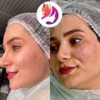 نیازمند مدل درمان مشکلات پوستی