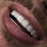 جشنواره کامپوزیت ، لمینیت ViP