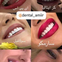 کامپوزیت دندان فکی۵میلیون عصبکشی۹۰۰تمام خدمات  قسط|خدمات آرایشگری و زیبایی|تهران, سعادت‌آباد|دیوار