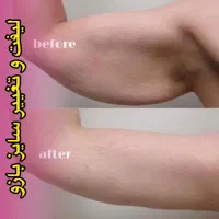 لاغری تضمینی تا ۵۰ درصد تخفیف و یک جلسه هدیه