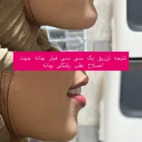 مطب زیبایی لیزر بوتاکس ژل مزو نخ لک جوش|خدمات آرایشگری و زیبایی|لردگان, |دیوار