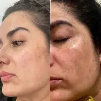 کرم بیوممتیک ۱۵ کاره ضد لک|آرایشی، بهداشتی، درمانی|قم, میدان نو|دیوار