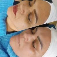 فیشیال پوست|خدمات آرایشگری و زیبایی|فلاورجان, |دیوار