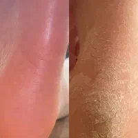 کراتین پروتئین تراپی پدیکور کف سابی تضمینی|خدمات آرایشگری و زیبایی|مشهد, احمدآباد|دیوار