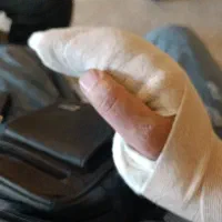 نوبت برا ام ار ای کمر