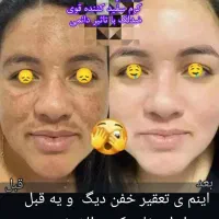 کرم شب|آرایشی، بهداشتی، درمانی|قم, شاه ابراهیم|دیوار