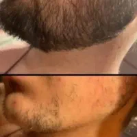 کاشت ممنوع