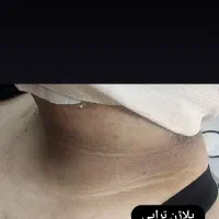 فیشیال تخصصی پوست