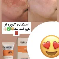 کرم ضدلک بیومیتیک