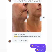 جوانساز جهانی بیوممتیک|آرایشی، بهداشتی، درمانی|ساری, |دیوار