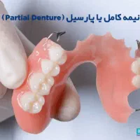 دندانسازی امیر دنت|آرایشی، بهداشتی، درمانی|اردبیل, |دیوار