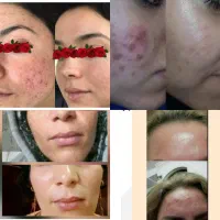 مشاوره تخصصی طب سنتی و  پاکسازی  بدن