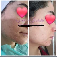 مرکز پاکسازی تخصصی جوان سازی پوست و اموزشvip|خدمات آرایشگری و زیبایی|مرودشت, بیست متری بیمارستان|دیوار