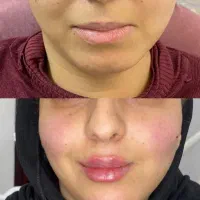خدمات پرسینگ ،آموزش ژل و بوتاکس فقد ۶ تومن