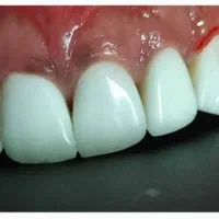 خدمات دندانپزشکی اقساطی بدون چک حتی زیر ۱۰ میلیون