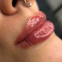 تزریق چربی، فیلر،بوتاکس/ساکشن چربی وتخلیه غبغب|خدمات آرایشگری و زیبایی|شهرضا, |دیوار