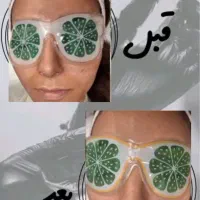 تخفییفات پاکسازی و فشیال بانوان و اقایان درکلینیک