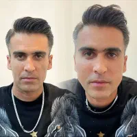 آف ویژه فیلر فول فسی  و مدلینگ صورت فقط ۳۹۰۰|خدمات آرایشگری و زیبایی|کرج, گوهردشت|دیوار