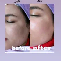 خدمات تخصصی فیشال|خدمات آرایشگری و زیبایی|مشهد, کوی سیدی|دیوار