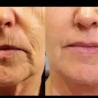 بیوممتیک جوانه گندم ایتالیایی|آرایشی، بهداشتی، درمانی|تهران, شیراز|دیوار