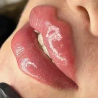 جشنواره ژل،بوتاکس، مزوژل