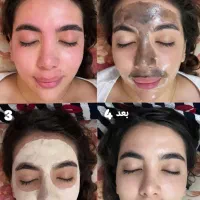 فیشیال کلاسیک ویژه بانوان