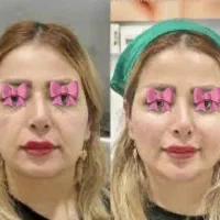 خدمات تخصصی پوست و مو در کلینیک فرسیما|خدمات آرایشگری و زیبایی|اسلام‌شهر, باغ فیض|دیوار