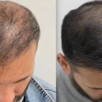 تو ام اگه به موهات و زیباییت اهمیت میدی پیام بده