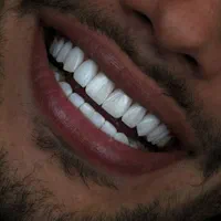 کامپوزیت ونیر لمینیت  عصب کشی ترمیم روکش ایمپلنت|خدمات آرایشگری و زیبایی|تهران, تهرانپارس شرقی|دیوار