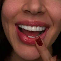 کامپوزیت لمینت عصب کشی کرج در دندانپزشکی ماهانا