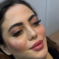 ژل لب روسی بوتاکس هیرفیلر کانتورینگ لیفت صورت|خدمات آرایشگری و زیبایی|تهران, دریا|دیوار