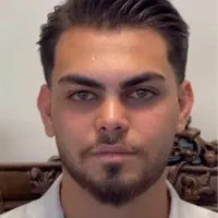 جراحی بینی اقساطی(ماهانه 10)