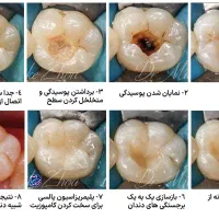 خدمات تخصصی ترمیم دندان