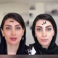 فقط فردا ۹۸۰ /کانتورینگ/فیلر/تعدادمحدود|خدمات آرایشگری و زیبایی|رشت, کوی حسینی|دیوار