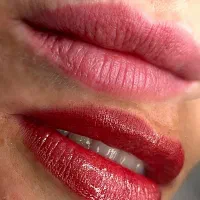 ریموو تتو قدیمی،میکرو بلیدینگ و میکرو پیگمنتینشن