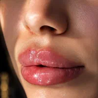 فیلربوتاکس
