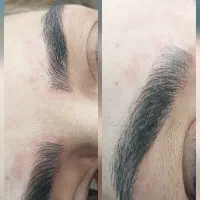 مدل میکروبلیدینگ فوری