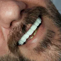 دندانپزشکی.کامپوزیت.روکش دندان.لمینت.ترمیم|خدمات آرایشگری و زیبایی|کرمانشاه, |دیوار