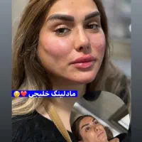 تزریق ژل بوتاکس توسط پزشک|خدمات آرایشگری و زیبایی|کرمانشاه, |دیوار