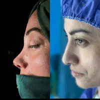 آف عمل بینی ۲۰ م فقط برای این هفته در اهواز