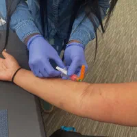 حجامت بادکش امبدینگ طب سوزنی زگیل تناسلی hpv|خدمات آرایشگری و زیبایی|اصفهان, فیض|دیوار