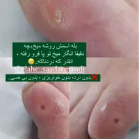 خدمات پودولوژی و پدیکور درمانی ، تخلیه میخچه و ..|خدمات آرایشگری و زیبایی|تهران, فردوس|دیوار
