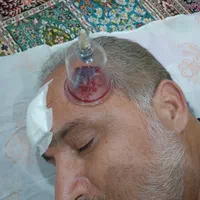 طب سنتی ایرانی.تزریقات.حجامت و..