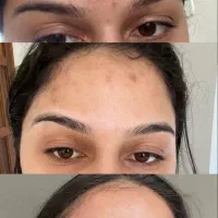 پاکسازی کبدچرب فقط در 40 روز|خدمات آرایشگری و زیبایی|گرگان, |دیوار