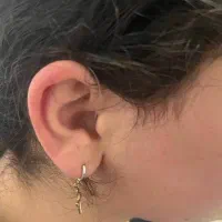 ارائه سمعک و ارزیابی شنوایی کودک و بزرگسال
