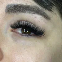 کاشت و ترمیم مژه